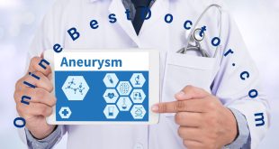What is Aneurysm Causes and Treatment?