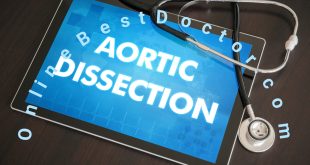 Aortic Dissection Symptoms and Treatment