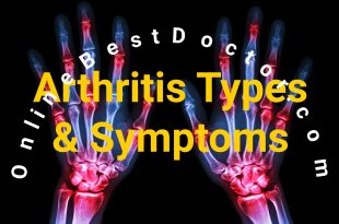 Arthritis Types and Symptoms