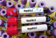 Hepatitis Causes