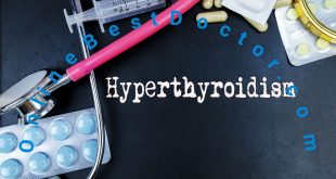 What are the Main Causes of Hyperthyroidism?
