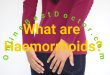 Fastest Way to Get Rid of Hemorrhoids