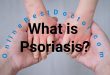 Main Cause of Psoriasis