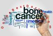 Bone Cancer Causes and Treatment