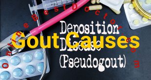 Gout Causes and Treatment