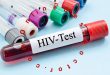 HIV Symptoms & Treatment