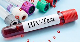 HIV Symptoms & Treatment