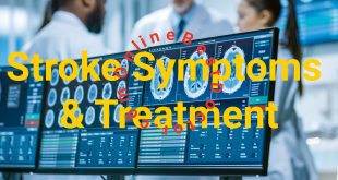 Stroke Symptoms and Treatment